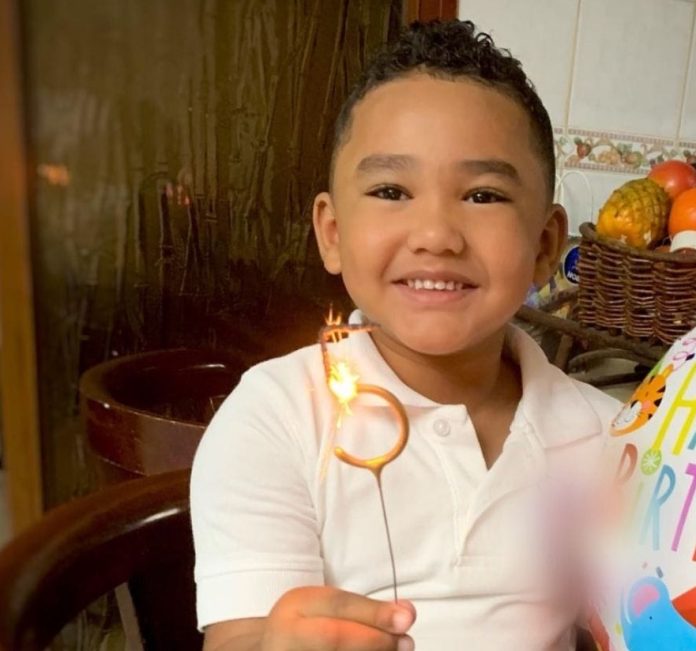 Muere uno de los niños que resultaron con quemaduras por fuegos artificiales en Carnaval de Salcedo