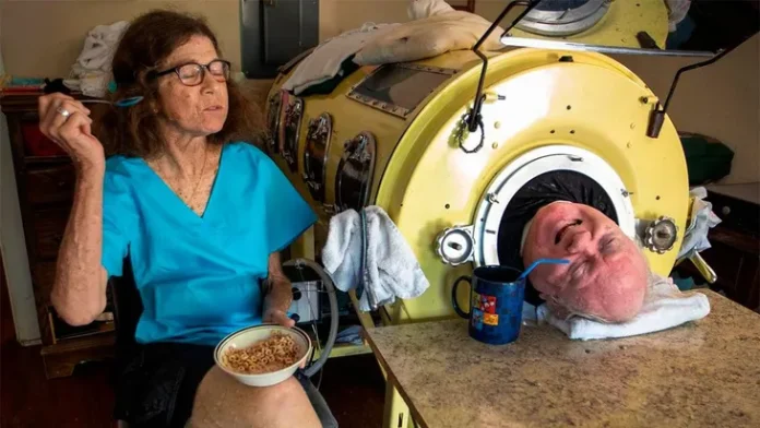 Murió a los 78 años Paul Alexander, el hombre que vivía en un pulmón de acero