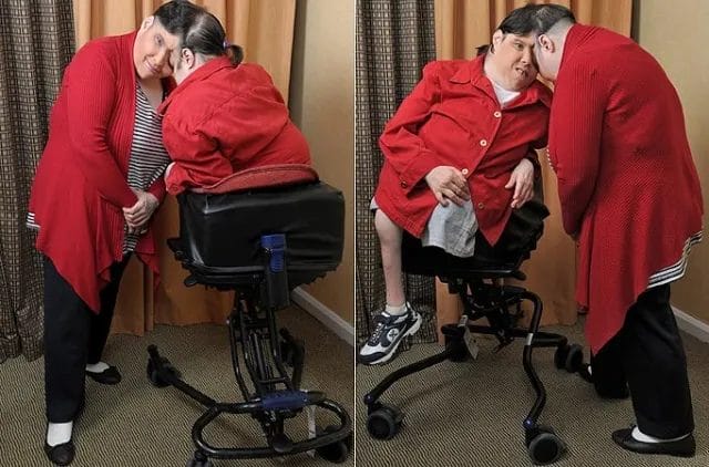 Mueren a los 62 años los siameses más longevos del mundo Mueren a los 62 años los siameses más longevos del mundo