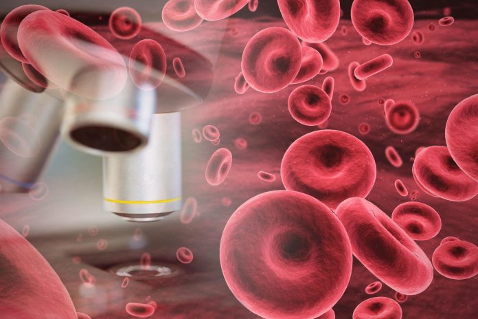 Estrategia podría ampliar donantes de células madre para personas que luchan contra el cáncer de sangre