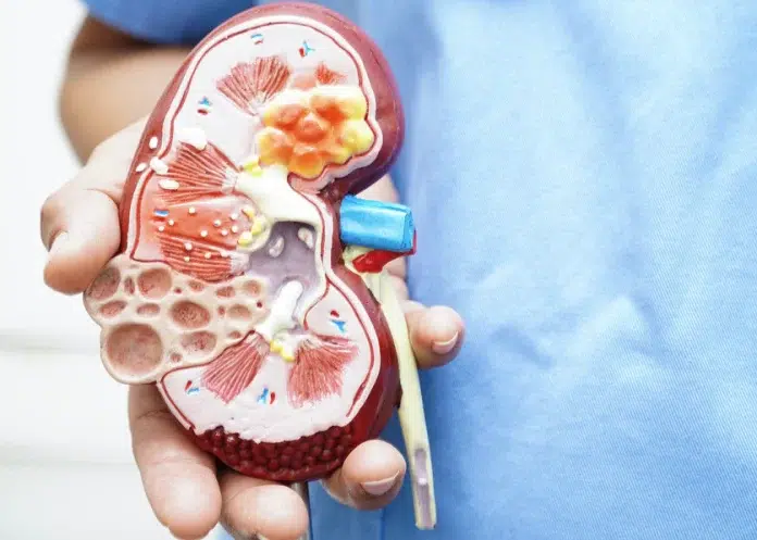 Una cura para el cáncer de riñón podría ser una realidad con esta innovadora vacuna