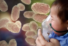 Confirman tres muertes por tos ferina en Honduras en 2026 La distribución geográfica de los infectados muestra una dispersión inusual que preocupa a las autoridades.