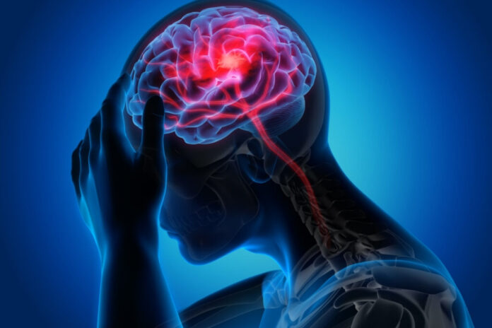 Cuando esta estructura se daña, la comunicación cerebral se ve afectada, lo que puede provocar alteraciones neurológicas.