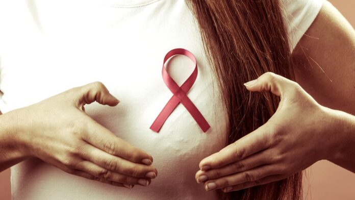El 60 % de los casos de cáncer de mama en RD se detecta en etapas avanzadas, según especialistas