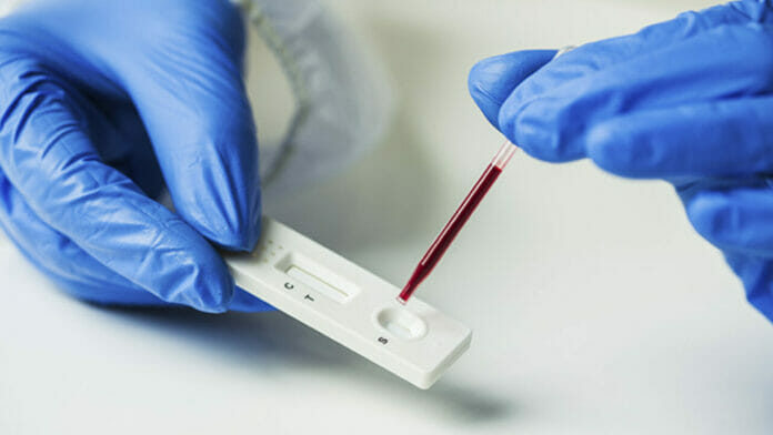 Ordenan retirar del mercado los lotes de test de antígenos para Covid por contaminación bacteriana