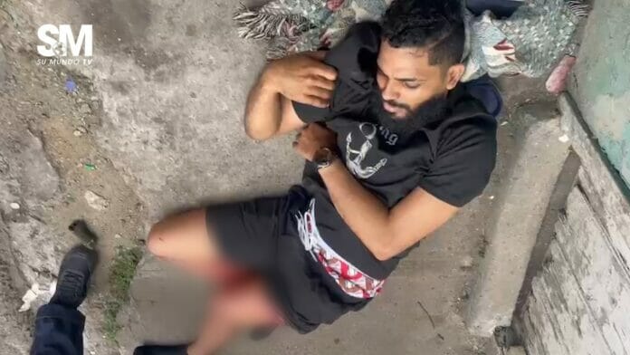 Protestas en SFM deja como resultado un joven herido en una pierna