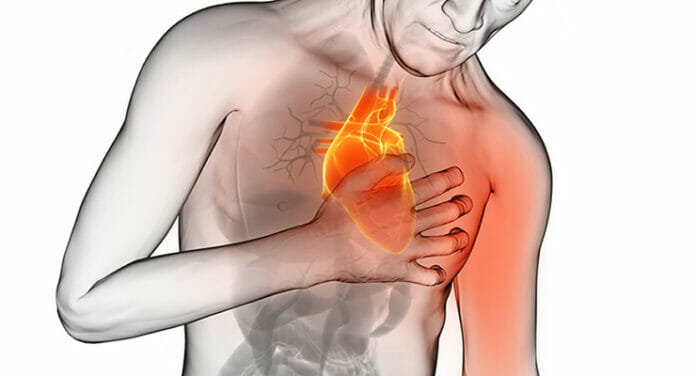Síntomas que pueden alertarte de un ataque al corazón