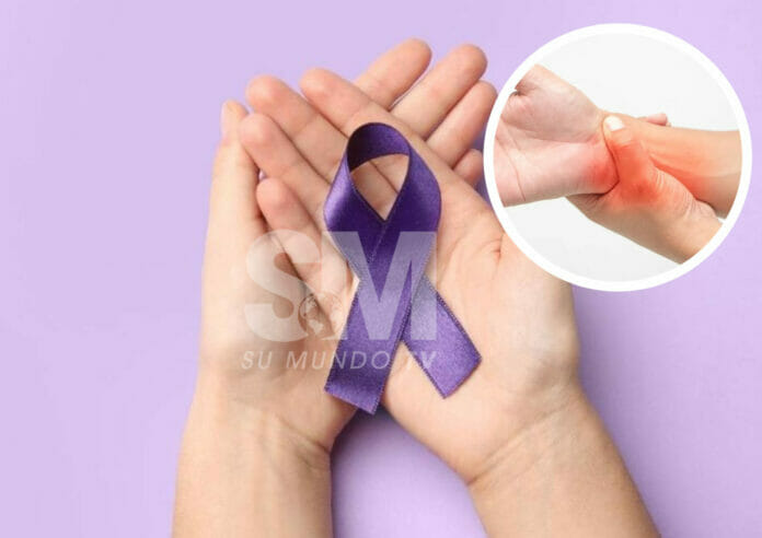 Recomendaciones a tomar ante un diagnóstico de Lupus