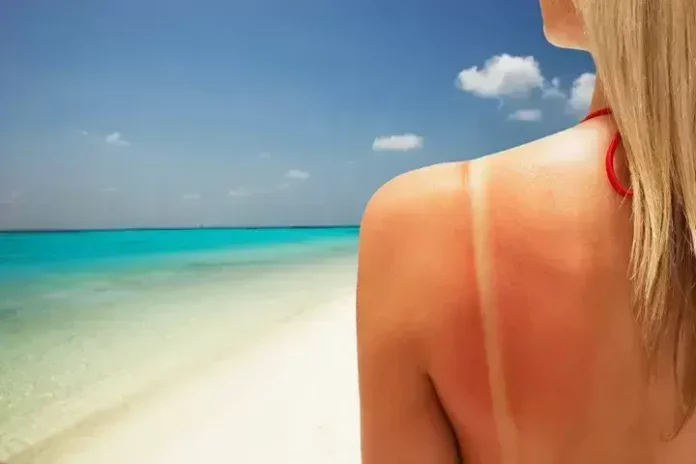 Cáncer de piel: la amenaza del verano y las altas temperaturas