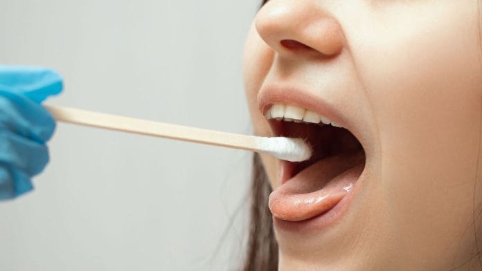 Crean test de saliva capaz de detectar el cáncer de mama en 5 segundos