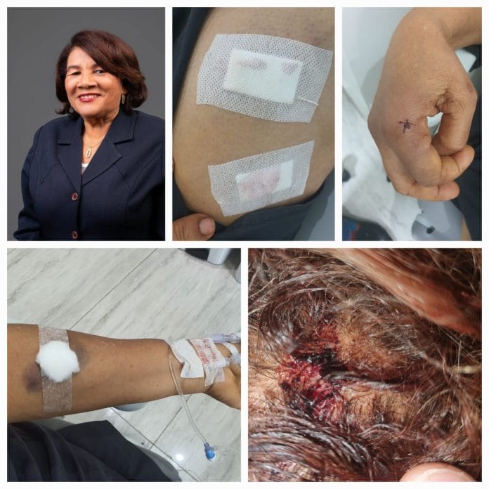 Extraño hiere candidata a diputada Cleo Sánchez dentro de su hogar