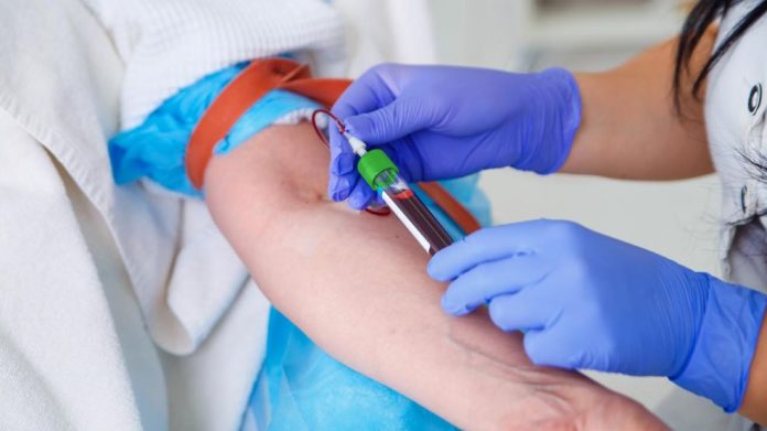 Si donas sangre con regularidad podrías estar beneficiando tu salud