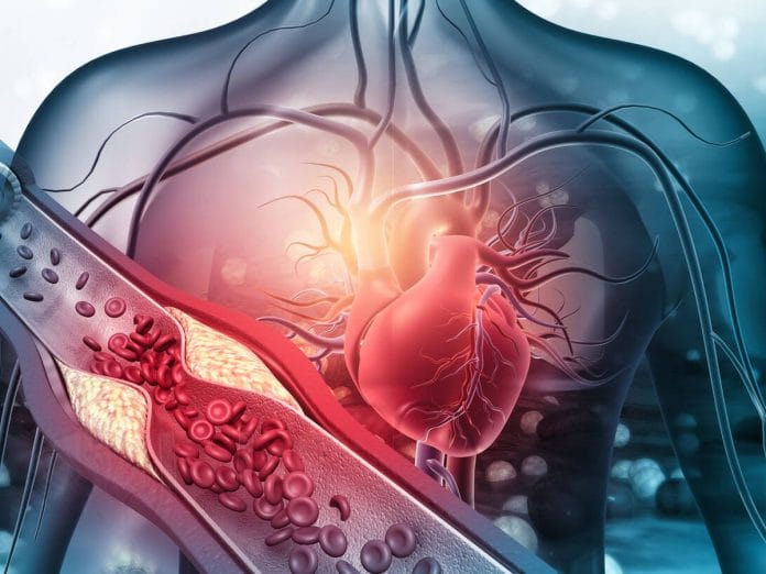 Qué es el síndrome metabólico y cómo afecta la salud del corazón