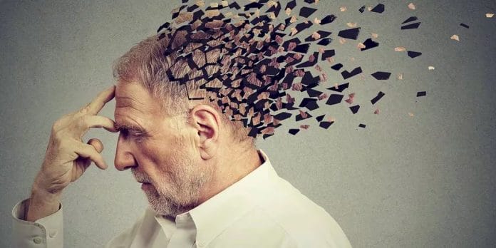 Nuevo hallazgo sobre el Alzheimer: el 20% de los casos podrían tener origen genético