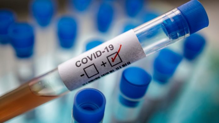 Casos activos de COVID-19 en el país descienden a 45
