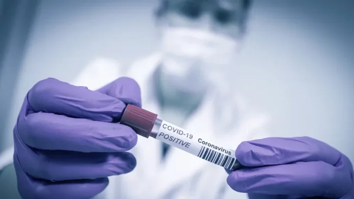 Se registran 109 nuevos contagios de covid en el país