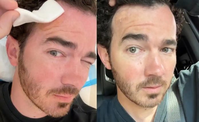 Kevin Jonas reveló que padece cáncer de piel: “Asegúrense de revisar esos lunares”