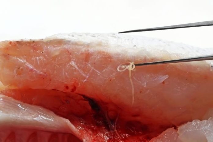 Investigadores apuntan una posible relación entre el anisakis y el cáncer de colon