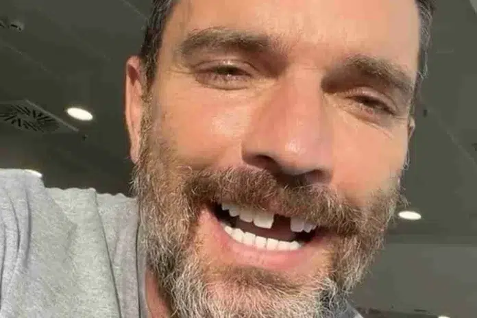 Julián Gil pierde de un diente durante grabación del reality show 