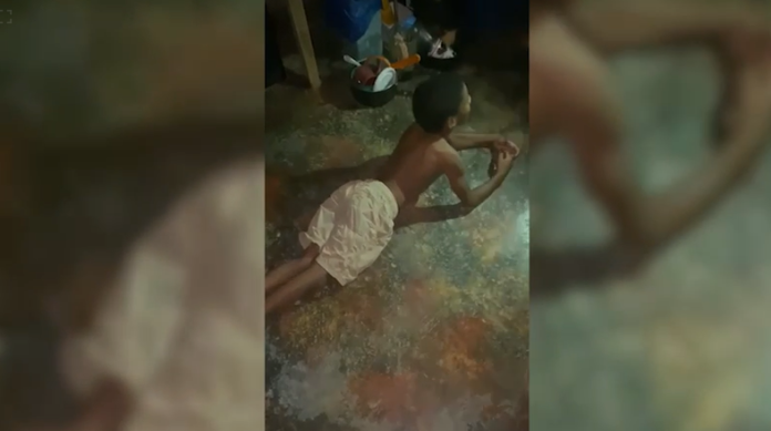 Familiares de niño con parálisis cerebral solicitan ayuda para cirugía