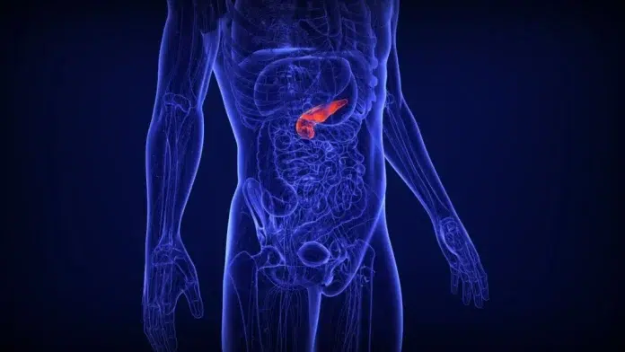 Los casos de cáncer de páncreas aumentan en menores de 50 años