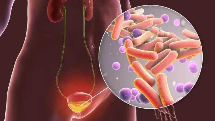 En ensayos con modelos animales y en las primeras pruebas con humanos, las bacterias intestinales artificiales diseñadas para tratar los cálculos renales colonizaron con éxito el microbioma intestinal.