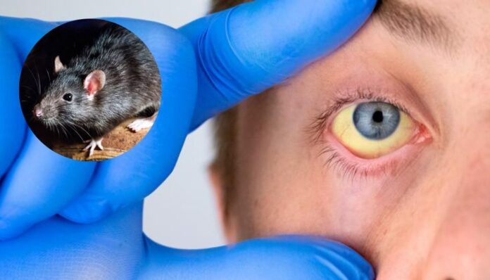 Otras enfermedades y eventos priorizados bajo vigilancia epidemiológica, como el Cólera y COVID-19, no registraron casos durante la SE-05, de acuerdo con los reportes de la Dirección de Epidemiologia.