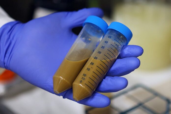 trasplante fecal