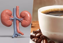 Tomar más de tres tazas de café al día podría aumentar el riesgo de daño renal, advierte estudio Tomar más de tres tazas de café al día podría aumentar el riesgo de daño renal, advierte estudio